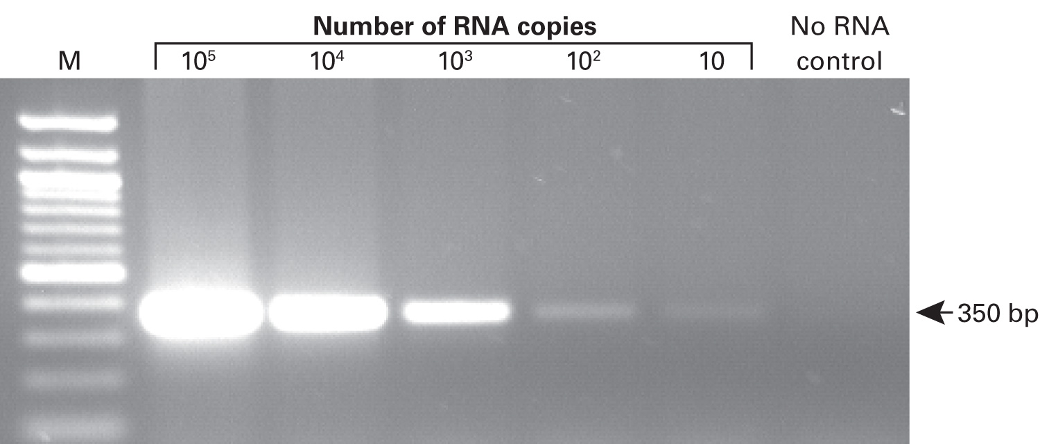 SMARTScribe RT exhibits exceptional sensitivity