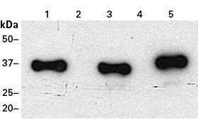 Easily detect ProteoTuner shield system DD fusions with the DD Monoclonal Antibody