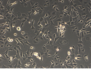 Phase contrast microscopy image of the Adeno-X 293 Cell Line