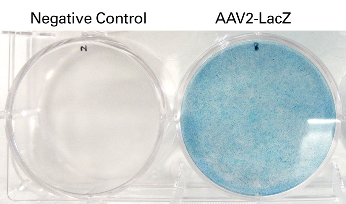 X-gal staining of HT1080 cells infected with AAV2-LacZ