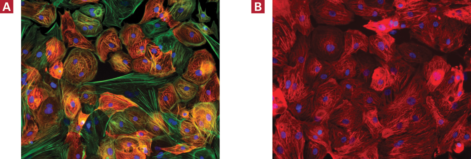 Cellartis Cardiomyocytes (from ChiPSC22) express cardiomyocyte markers, including cTroponin (red)