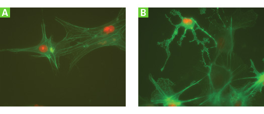 Lentiviral vector delivery of fluorescently labeled protein expression to human neural progenitor cells