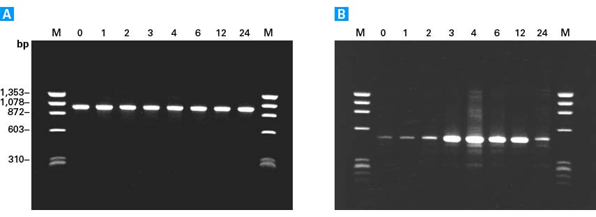 The reliability of cDNA synthesized with the Advantage RT-for-PCR Kit
