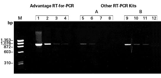 PCR amplification of cDNA synthesized with the Advantage RT-for-PCR Kit vs. cDNA synthesized with kits from two competitors