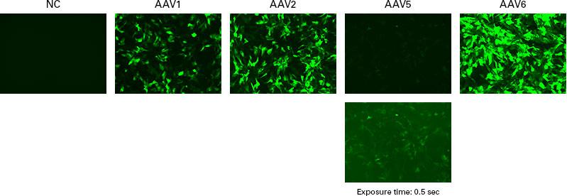 Gene transduction of iPSC-derived cardiomyocytes using AAV1, 2, 5, and 6.