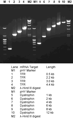 Amplifying various lengths of target gene mRNAs by RT-PCR