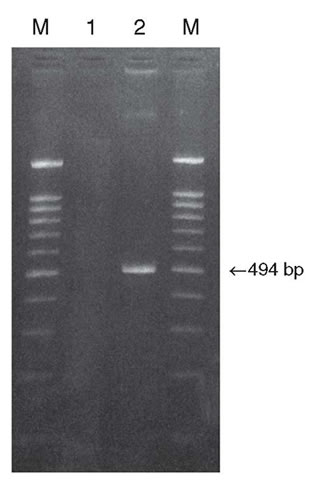 Amplification of human TRADD gene