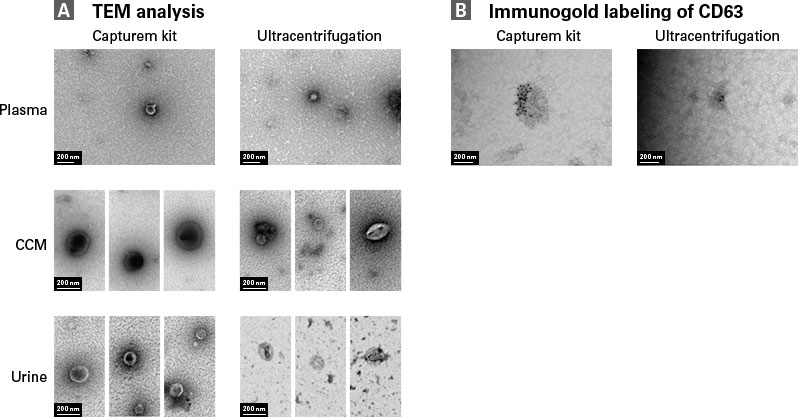 Classical size, morphology, and surface protein expression for Caputrem EVs