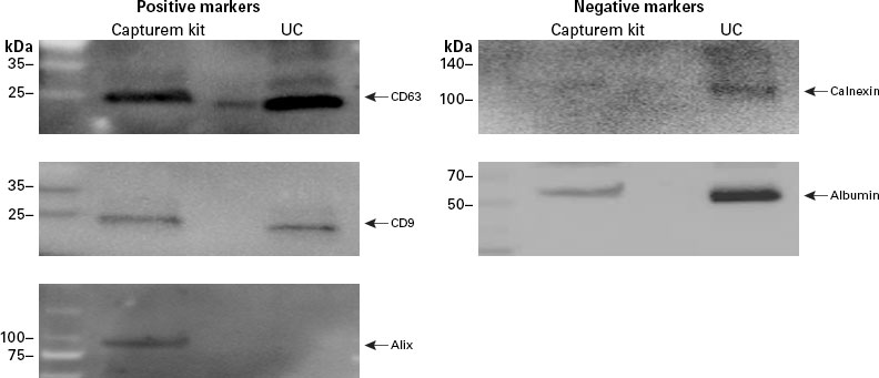 Capturem-isolated EV samples show proper protein expression