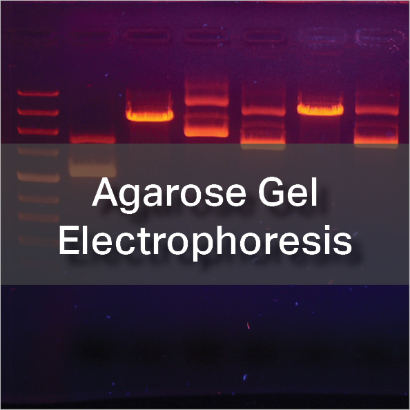 Agarose Gel Electrophoresis