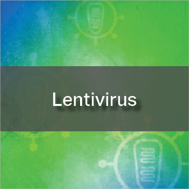 Lentivirus