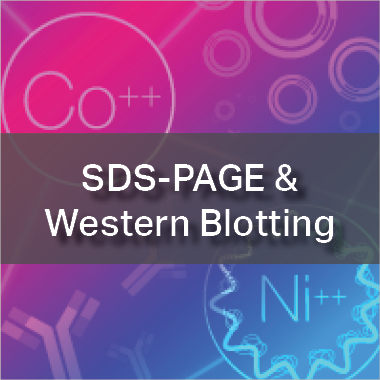 SDS-PAGE & Western Blotting