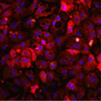 Human Stem Cell-derived Hepatocytes